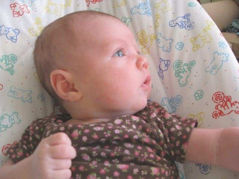 Types of Baby Rashes