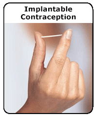 Implantable Contraception