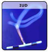 The IUD