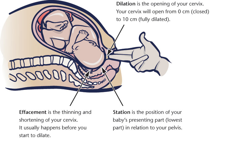 The First Stage of Labour - Early Phase