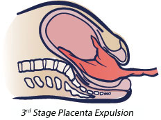 Information on the Third Stage of Labour