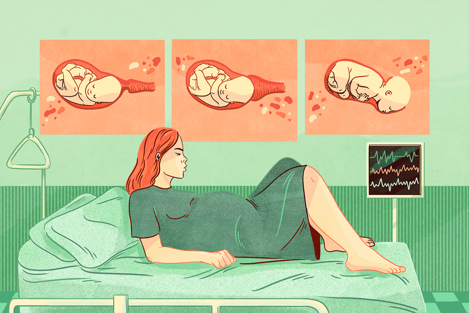 What Is Dilation in Pregnancy?