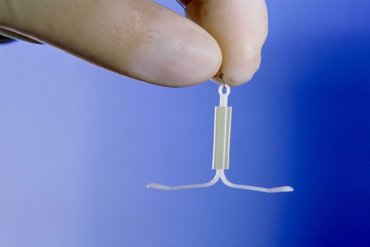 How to Be a Candidate for Getting an IUD